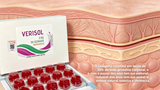 GOMA VERISOL MORANGO 2,5 - 30 UN